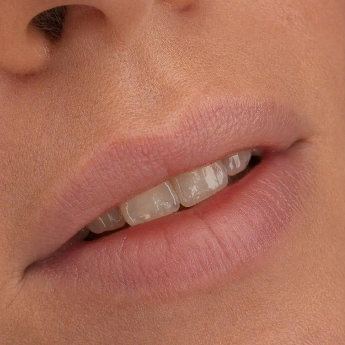 Lippenpigmentierung bei Xenia Frank Salach- sanfte Farbergebnisse Lippen vor der Lippenpigmentierung mit blasser natürlicher Lippenfarbe ohne Kontur