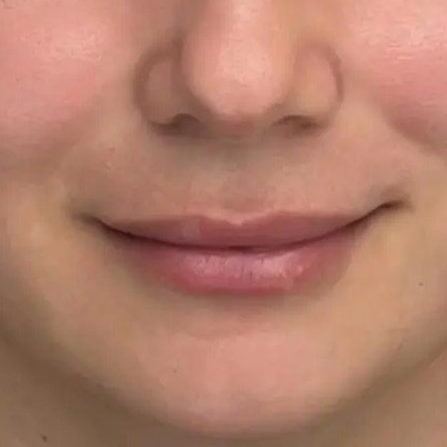Lippenpigmentierung bei Xenia Frank Salach- sanfte Farbergebnisse Lippen vor der Lippenpigmentierung – natürliche Lippen ohne definierte Farbe